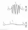 Fig. 03 - Monofilament implants and systems for delivery thereof