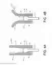 Fig. 05 - Monofilament implants and systems for delivery thereof