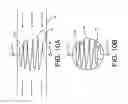Fig. 13 - Monofilament implants and systems for delivery thereof