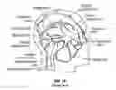 Fig. 02 - Methods, systems and devices for treatment of cerebrospinal venous insufficiency and multiple sclerosis