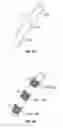 Fig. 06 - Methods, systems and devices for treatment of cerebrospinal venous insufficiency and multiple sclerosis
