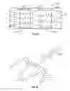 Fig. 09 - Methods, systems and devices for treatment of cerebrospinal venous insufficiency and multiple sclerosis