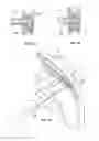 Fig. 02 - Medical device delivery system and method