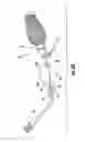 Fig. 09 - SURGICAL TOOL AND METHOD