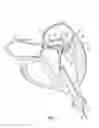 Fig. 02 - Replacement heart valve systems and methods