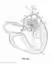 Fig. 08 - Replacement heart valve systems and methods