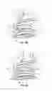 Fig. 09 - Replacement heart valve systems and methods