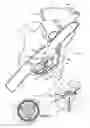 Fig. 01 - Anchor-Delivery Sheath Tip