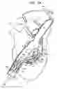 Fig. 06 - Anchor-Delivery Sheath Tip