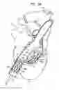 Fig. 08 - Anchor-Delivery Sheath Tip