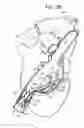 Fig. 09 - Anchor-Delivery Sheath Tip