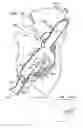 Fig. 33 - Anchor-Delivery Sheath Tip