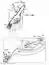 Fig. 52 - Anchor-Delivery Sheath Tip