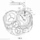 Fig. 06 - Expandable heart valve coaptation device