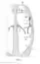 Fig. 07 - Expandable heart valve coaptation device