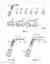Fig. 02 - Devices and methods to prevent joint instability following arthroplasty