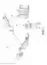 Fig. 02 - Orthopaedic surgical system for determining joint forces of a patient's knee joint