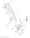 Fig. 03 - Orthopaedic surgical system for determining joint forces of a patient's knee joint