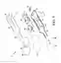 Fig. 05 - Orthopaedic surgical system for determining joint forces of a patient's knee joint
