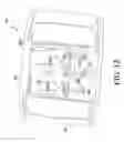 Fig. 12 - Orthopaedic surgical system for determining joint forces of a patient's knee joint