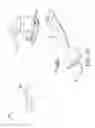 Fig. 18 - Orthopaedic surgical system for determining joint forces of a patient's knee joint