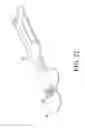 Fig. 20 - Orthopaedic surgical system for determining joint forces of a patient's knee joint
