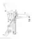 Fig. 30 - Orthopaedic surgical system for determining joint forces of a patient's knee joint