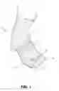 Fig. 02 - Therapeutic sock