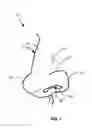 Fig. 02 - NASAL DILATOR APPARATUS