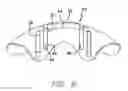 Fig. 07 - Dental Sleep Apnea Device