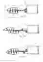 Fig. 02 - METHODS AND APPARATUSES FOR PERFORMING REMOTE TITRATION OF MANDIBULAR PROTRUSION