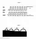 Fig. 03 - Detachable miniature microscope mounted keratometer for cataract surgery