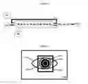 Fig. 04 - Detachable miniature microscope mounted keratometer for cataract surgery