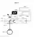 Fig. 08 - Detachable miniature microscope mounted keratometer for cataract surgery