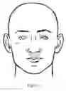 Fig. 02 - Nasal compression device