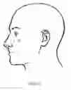 Fig. 03 - Nasal compression device