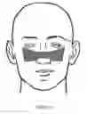 Fig. 09 - Nasal compression device