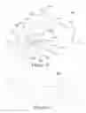 Fig. 11 - Nasal compression device
