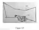 Fig. 12 - Nasal compression device