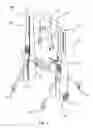 Fig. 02 - Body lightening system for gait training