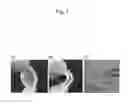 Fig. 02 - SUBCUTANEOUS IMPLANT-TYPE DEVICE FOR CELL TRANSPLANTATION THERAPY