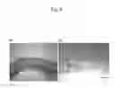 Fig. 09 - SUBCUTANEOUS IMPLANT-TYPE DEVICE FOR CELL TRANSPLANTATION THERAPY