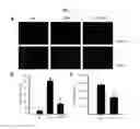 Fig. 02 - PHARMACEUTICAL COMPOSITION FOR STROKE TREATMENT BASED ON AMPK INHIBITION