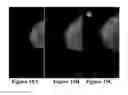 Fig. 14 - Methods of reducing mammographic breast density and/or breast cancer risk