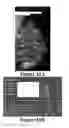 Fig. 15 - Methods of reducing mammographic breast density and/or breast cancer risk