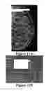 Fig. 16 - Methods of reducing mammographic breast density and/or breast cancer risk