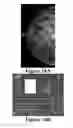 Fig. 17 - Methods of reducing mammographic breast density and/or breast cancer risk