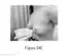 Fig. 23 - Methods of reducing mammographic breast density and/or breast cancer risk