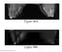 Fig. 29 - Methods of reducing mammographic breast density and/or breast cancer risk