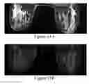 Fig. 30 - Methods of reducing mammographic breast density and/or breast cancer risk